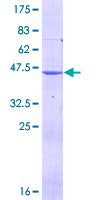 DHFR Protein - 12.5% SDS-PAGE of human DHFR stained with Coomassie Blue