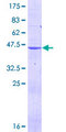 DHFR Protein - 12.5% SDS-PAGE of human DHFR stained with Coomassie Blue
