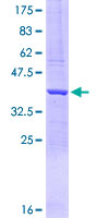 DHFR Protein - 12.5% SDS-PAGE Stained with Coomassie Blue.
