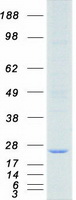 DHFR Protein - Purified recombinant protein DHFR was analyzed by SDS-PAGE gel and Coomassie Blue Staining