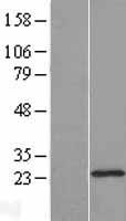 DHFRL1 Protein - Western validation with an anti-DDK antibody * L: Control HEK293 lysate R: Over-expression lysate