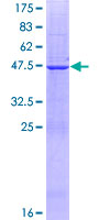 DHFRL1 Protein - 12.5% SDS-PAGE of human DHFRL1 stained with Coomassie Blue