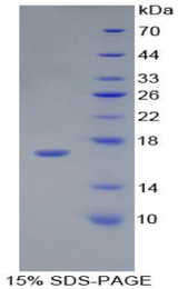 DHH / Desert Hedgehog Protein - Recombinant Hedgehog Homolog, Desert By SDS-PAGE
