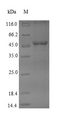 DHODH Protein - (Tris-Glycine gel) Discontinuous SDS-PAGE (reduced) with 5% enrichment gel and 15% separation gel.