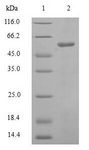 DHODH Protein - (Tris-Glycine gel) Discontinuous SDS-PAGE (reduced) with 5% enrichment gel and 15% separation gel.