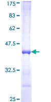 DHODH Protein - 12.5% SDS-PAGE Stained with Coomassie Blue.