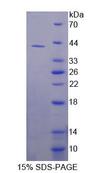 DHODH Protein - Recombinant  Dihydroorotate Dehydrogenase By SDS-PAGE