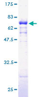 DHPS Protein - 12.5% SDS-PAGE of human DHPS stained with Coomassie Blue