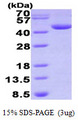 DHPS Protein