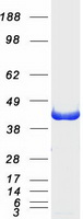 DHPS Protein - Purified recombinant protein DHPS was analyzed by SDS-PAGE gel and Coomassie Blue Staining