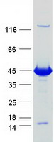 DHPS Protein - Purified recombinant protein DHPS was analyzed by SDS-PAGE gel and Coomassie Blue Staining