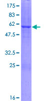 DHRS1 Protein - 12.5% SDS-PAGE of human DHRS1 stained with Coomassie Blue