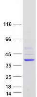 DHRS1 Protein - Purified recombinant protein DHRS1 was analyzed by SDS-PAGE gel and Coomassie Blue Staining
