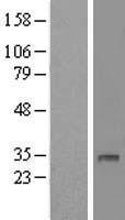 DHRS12 Protein - Western validation with an anti-DDK antibody * L: Control HEK293 lysate R: Over-expression lysate