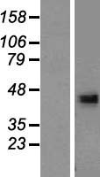 DHRS13 Protein - Western validation with an anti-DDK antibody * L: Control HEK293 lysate R: Over-expression lysate