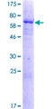DHRS13 Protein - 12.5% SDS-PAGE of human DHRS13 stained with Coomassie Blue