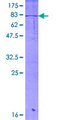 DHRS2 / HEP27 Protein - 12.5% SDS-PAGE of human DHRS2 stained with Coomassie Blue