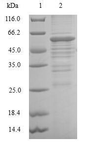 DHRS2 / HEP27 Protein - (Tris-Glycine gel) Discontinuous SDS-PAGE (reduced) with 5% enrichment gel and 15% separation gel.