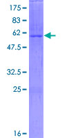 DHRS3 / SDR1 Protein - 12.5% SDS-PAGE of human DHRS3 stained with Coomassie Blue