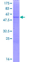 DHRS4 / PSCD Protein - 12.5% SDS-PAGE of human DHRS4 stained with Coomassie Blue