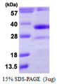DHRS4 / PSCD Protein
