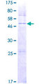 DHRS4L2 Protein - 12.5% SDS-PAGE of human DHRS4L2 stained with Coomassie Blue