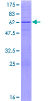 DHRS7 Protein - 12.5% SDS-PAGE of human DHRS7 stained with Coomassie Blue