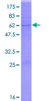 DHRS7B Protein - 12.5% SDS-PAGE of human DHRS7B stained with Coomassie Blue