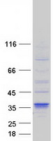 DHRS7B Protein - Purified recombinant protein DHRS7B was analyzed by SDS-PAGE gel and Coomassie Blue Staining