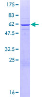 DHRS9 Protein - 12.5% SDS-PAGE of human DHRS9 stained with Coomassie Blue