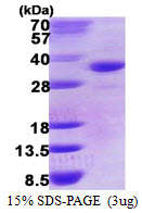 DHRS9 Protein