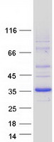 DHRS9 Protein - Purified recombinant protein DHRS9 was analyzed by SDS-PAGE gel and Coomassie Blue Staining