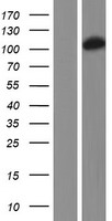 DHTKD1 Protein - Western validation with an anti-DDK antibody * L: Control HEK293 lysate R: Over-expression lysate