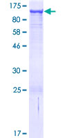 DHTKD1 Protein - 12.5% SDS-PAGE of human DHTKD1 stained with Coomassie Blue