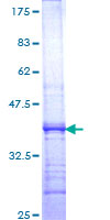 DHX16 / DBP2 Protein - 12.5% SDS-PAGE Stained with Coomassie Blue.