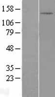 DHX30 Protein - Western validation with an anti-DDK antibody * L: Control HEK293 lysate R: Over-expression lysate