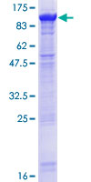 DHX32 Protein - 12.5% SDS-PAGE of human DHX32 stained with Coomassie Blue