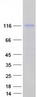 DHX34 Protein - Purified recombinant protein DHX34 was analyzed by SDS-PAGE gel and Coomassie Blue Staining