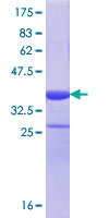 DHX38 Protein - 12.5% SDS-PAGE Stained with Coomassie Blue.