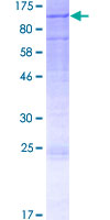 DHX40 Protein - 12.5% SDS-PAGE of human DHX40 stained with Coomassie Blue