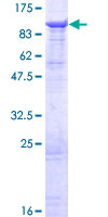 DHX58 / LGP2 Protein - 12.5% SDS-PAGE of human DHX58 stained with Coomassie Blue