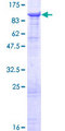 DHX58 / LGP2 Protein - 12.5% SDS-PAGE of human DHX58 stained with Coomassie Blue