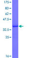 DHX8 Protein - 12.5% SDS-PAGE Stained with Coomassie Blue.