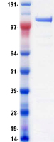 DHX8 Protein - Purified recombinant protein DHX8 was analyzed by SDS-PAGE gel and Coomassie Blue Staining