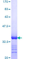 DHX9 Protein - 12.5% SDS-PAGE Stained with Coomassie Blue
