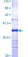 DIABLO / SMAC Protein - 12.5% SDS-PAGE Stained with Coomassie Blue.