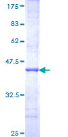 DIAPH1 Protein - 12.5% SDS-PAGE Stained with Coomassie Blue.