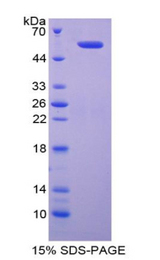 DIAPH1 Protein - Recombinant Diaphanous Homolog 1 By SDS-PAGE