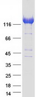 DIAPH1 Protein - Purified recombinant protein DIAPH1 was analyzed by SDS-PAGE gel and Coomassie Blue Staining