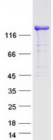 DIAPH1 Protein - Purified recombinant protein DIAPH1 was analyzed by SDS-PAGE gel and Coomassie Blue Staining